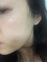 体验后-坤如玛丽·医疗美容中心