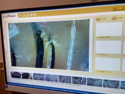 -丝客富脱发养发头皮馆