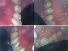 -同步齿科·数字化正畸种植口腔中心(前山店)