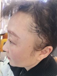 -长沙雅美医疗美容医院