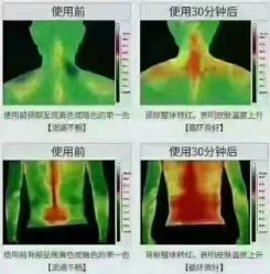 -安吉拉青春化管理中心
