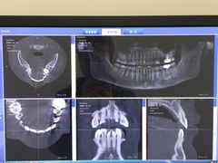-Dr.Z dental仁康种植矫正中心