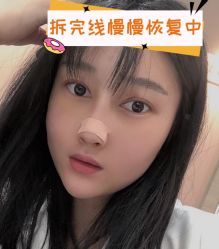 -素美医疗美容·西南眼鼻整形·修复基地