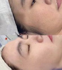 -薇兰专业脱毛连锁机构