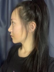 -杭州奥拉克医疗美容门诊部