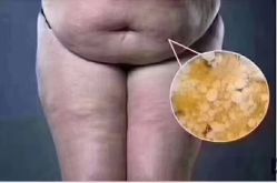 -香薇妮丝·定制减肥·身材管理