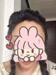 -碧莲盛·不剃发植发