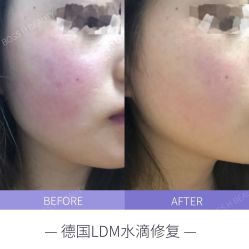 -Boss H Beauty美肌中心