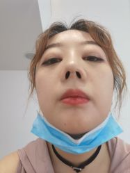 点击看大图 -成都艾特他整形外科医院