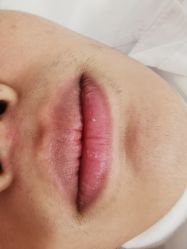 -薇兰专业脱毛连锁机构