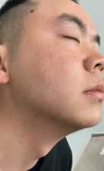 -ANRI安里·专业男士脱毛连锁