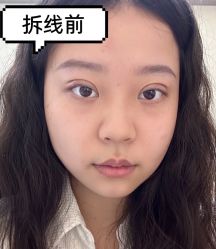 -素美医疗美容·西南眼鼻整形·修复基地