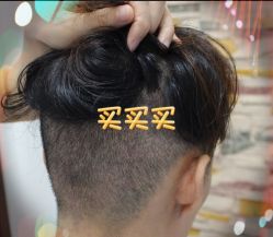 -大麦微针植发全国连锁