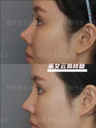 -北京米扬丽格医疗美容·联合丽格鼻整形中心