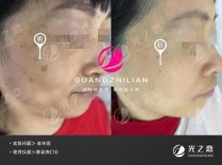 -星港国际·Skin皮肤专研·皮肤管理