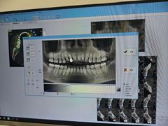 -甘家界牌柠檬鸭(青山店)