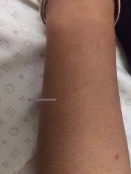 -肥三针腧穴瘦身馆