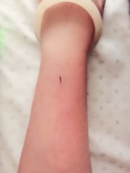 -肥三针腧穴瘦身馆