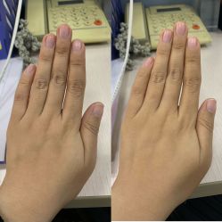 -嘉和医学脱毛中心