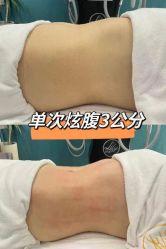 点击看大图 -Lily纤美·科技减脂中心