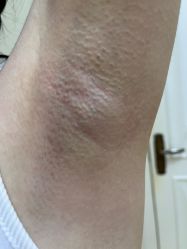 -南宁华美医疗美容医院