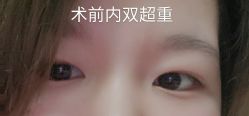 -八大处整形