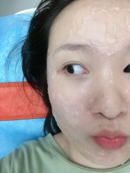体验前-西安伊美尔医疗美容医院