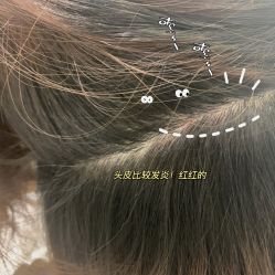 -LESSMORE科技头皮理容中心