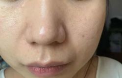 -康美贞·痘肌养护管理中心