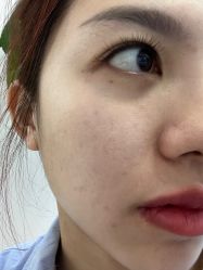 -瓷肌博士·祛痘科技美肤