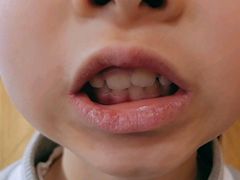 -上海仁爱医院口腔科 · 种植