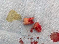 -同步齿科·数字化正畸种植口腔中心(珠海店)