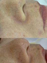 -蕾特恩专业祛痘·皮肤管理