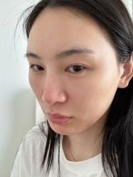 体验后-南京康美美容医院·旗舰店