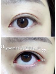 -YooMee优美智能科技美肤机构