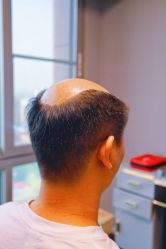 -型男帮男士假发补发·佩戴式发型