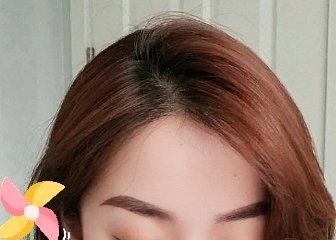 -大麦微针植发丨全国连锁