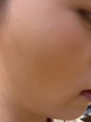 -长沙雅美医疗美容医院