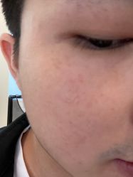 -丽美妍医疗美容·皮秒·立体分层抗衰
