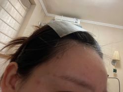 -苗方清颜祛痘·皮肤管理