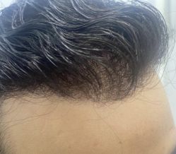 -发饰美男士增发补发假发定制店