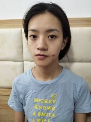 -成都军建医院·疤痕诊疗中心