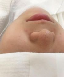 -苑苑vbeauty科技美容SPA