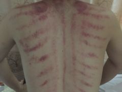 -益友堂盲人推拿正骨穴位按摩工作室