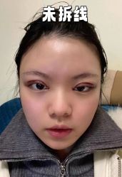 -素美医疗美容·西南眼鼻整形·修复基地