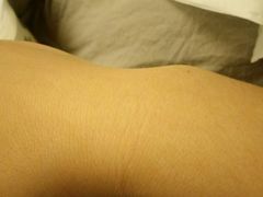 没扎的右手-北京市健宫医院