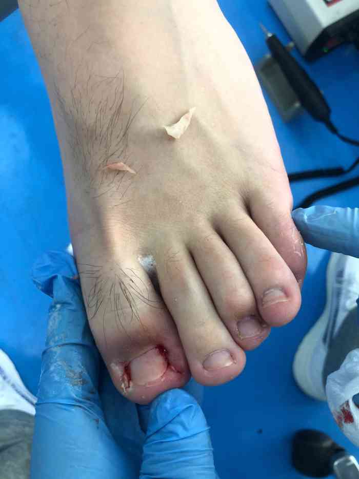 民医堂灰指甲甲沟炎专业扦脚(斜土路店)-"店面干净整洁,店长亲自接待