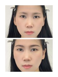-杨益美学·野生眉半永久纹眉发际线