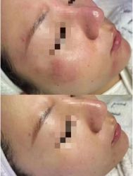 -LUNA皮相美·骨相美高级美感
