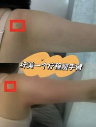 -Lily纤美·科技减脂中心